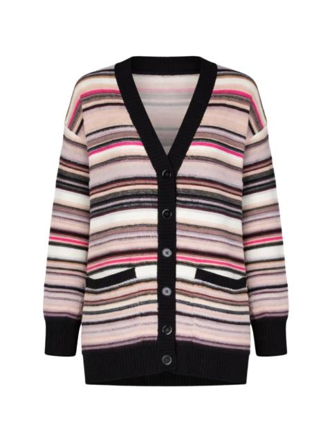 striped pockets cardigan