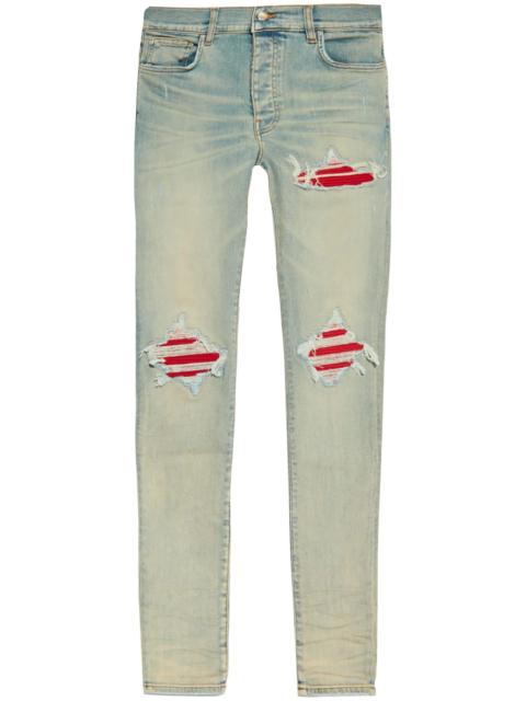 Amiri MX1 Skinny Jeans