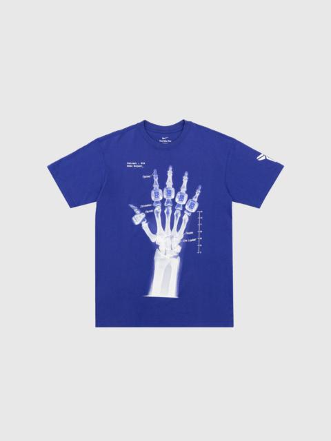 KOBE CREWNECK T-SHIRT "X-RAY"